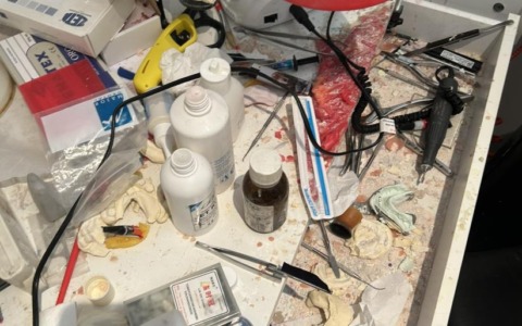 Scoperto studio dentistico abusivo, denunciato falso professionista